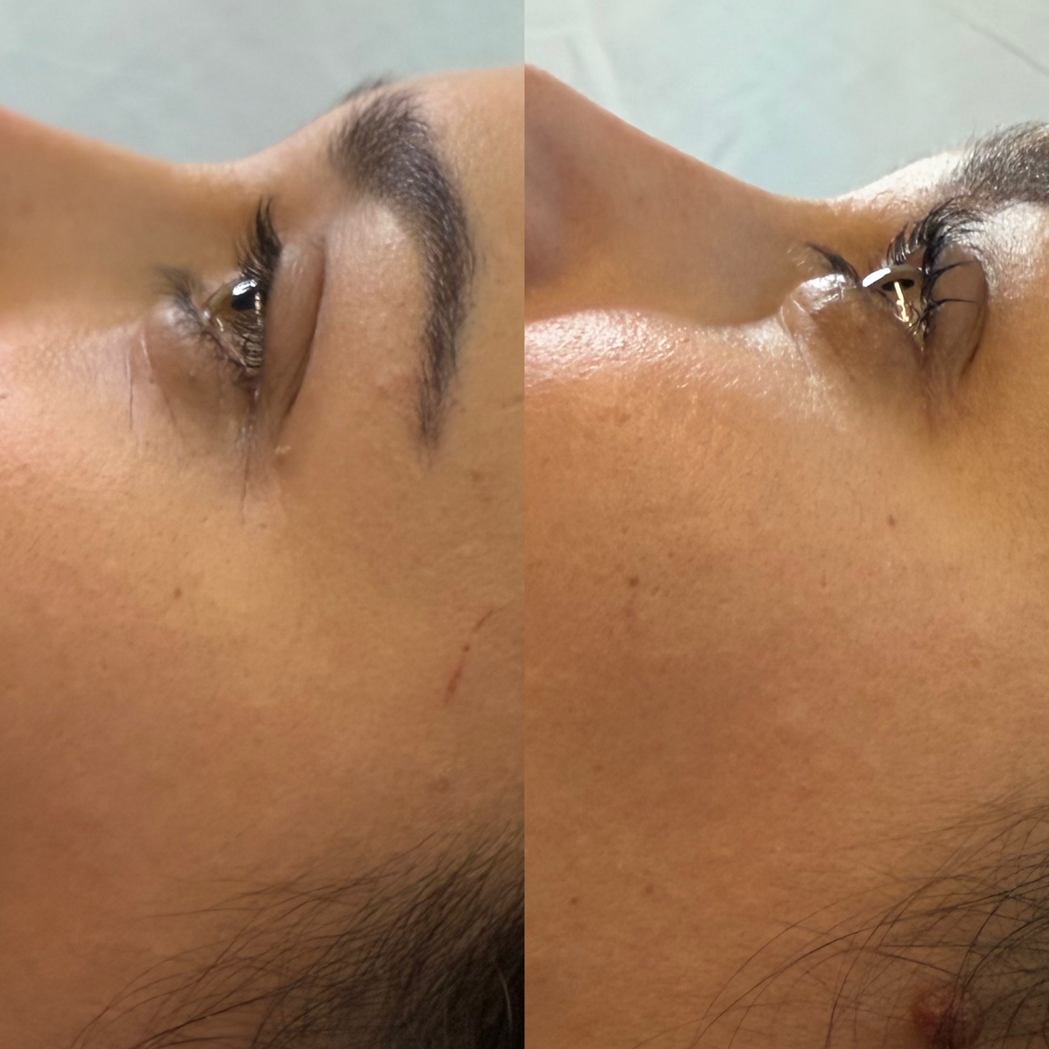 laminazione-ciglia-5